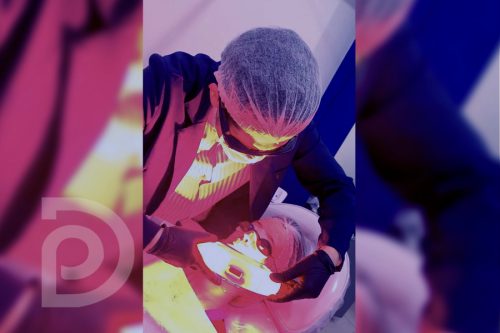 laser_drdiogopazzini